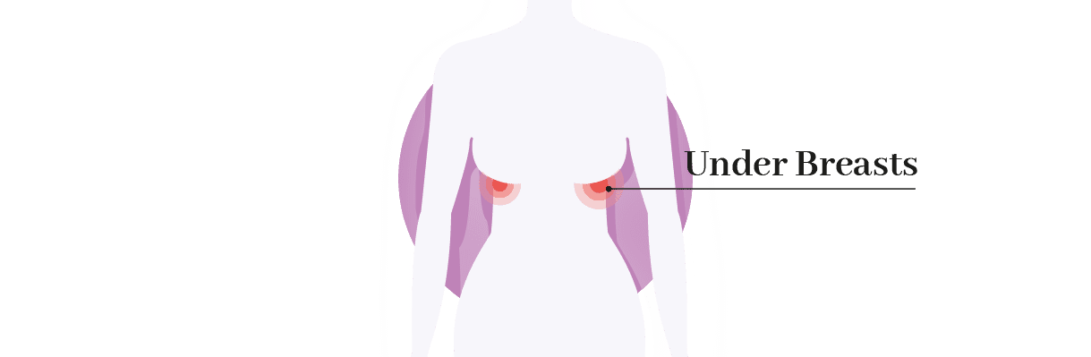 Chafing Under Breasts 