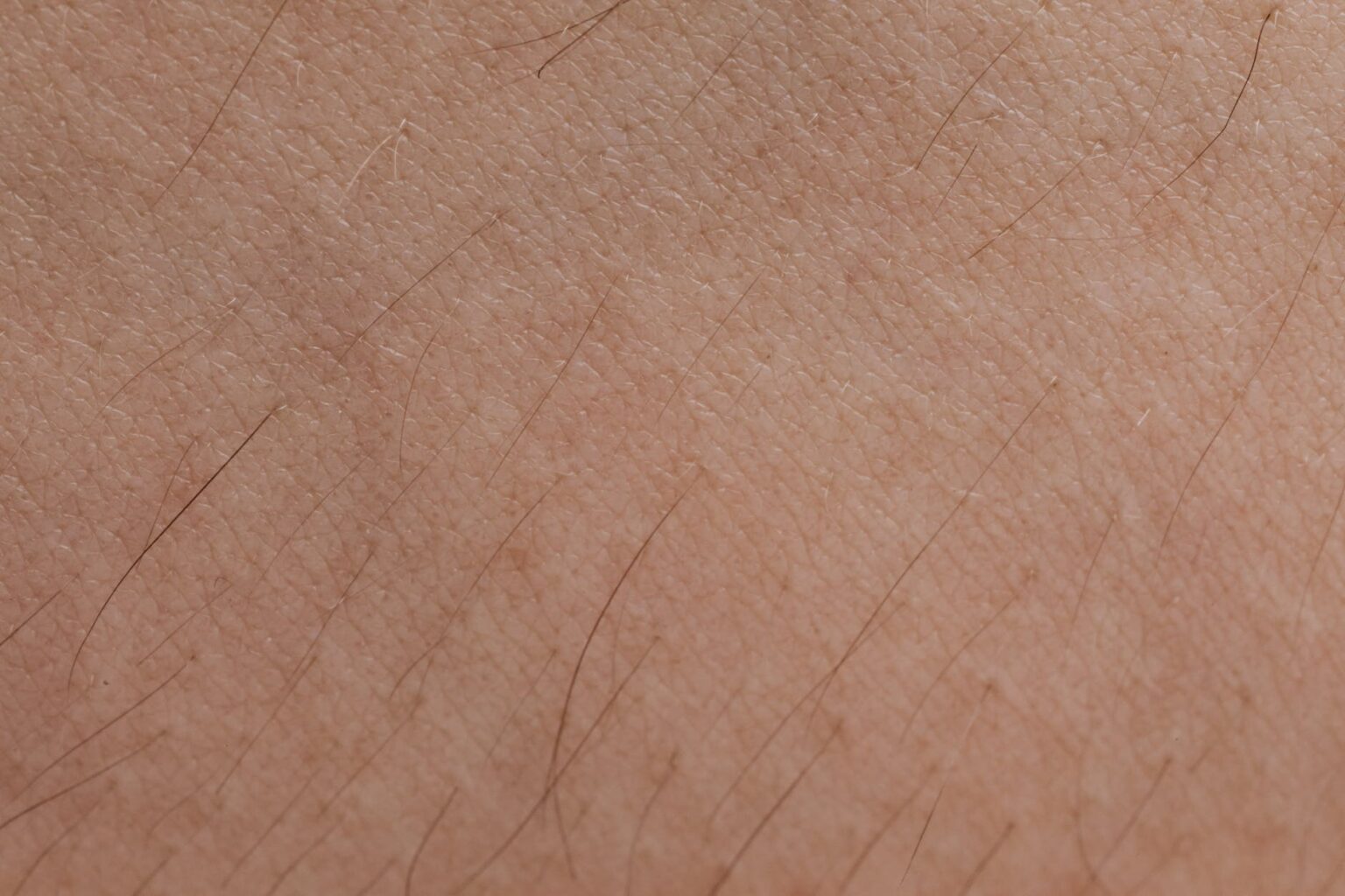 Chafing Unveiled Decoding the Visual Spectrum of Skin Irritation