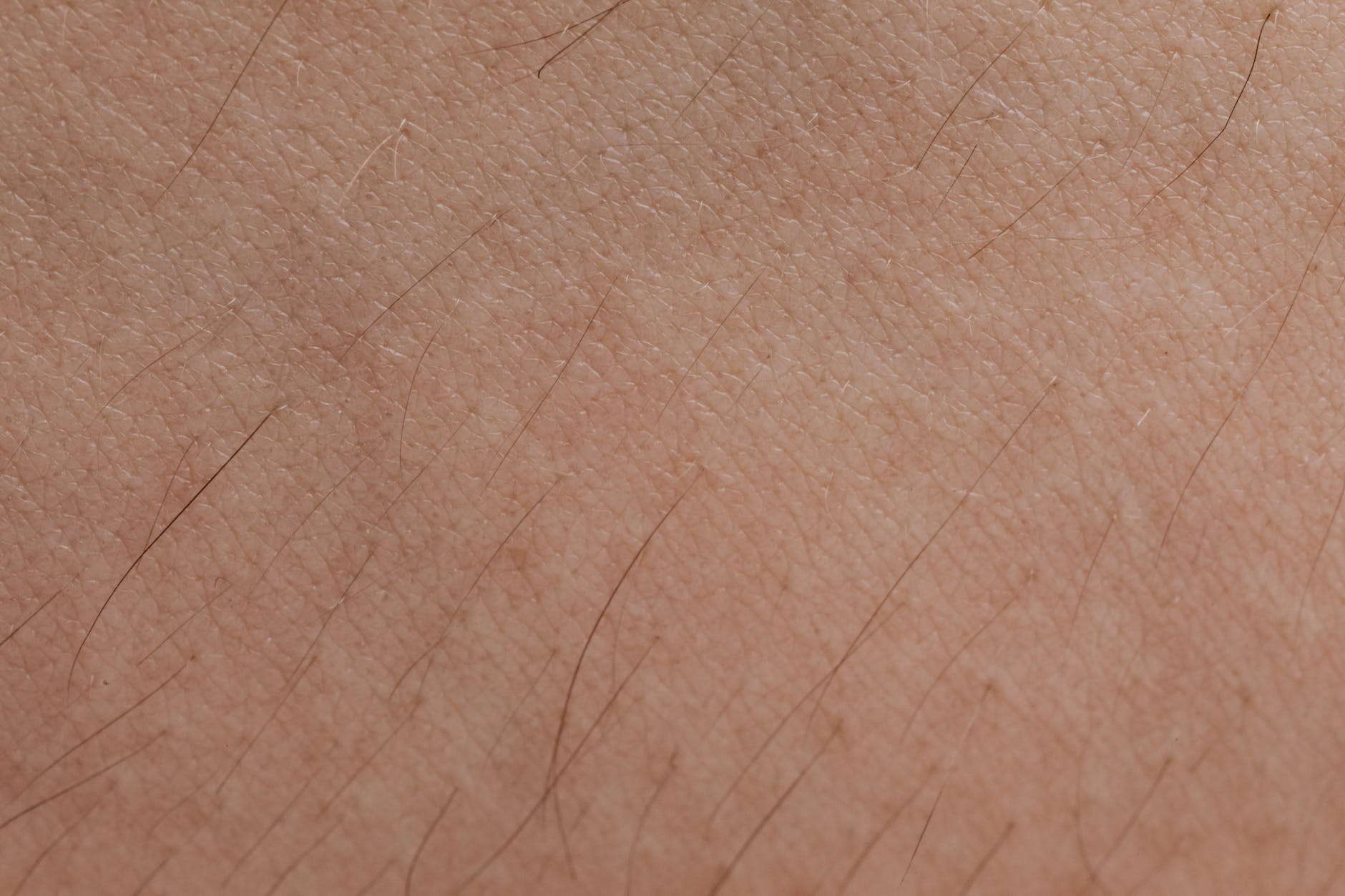 Chafing Unveiled Decoding the Visual Spectrum of Skin Irritation What Does Chafing Look Like